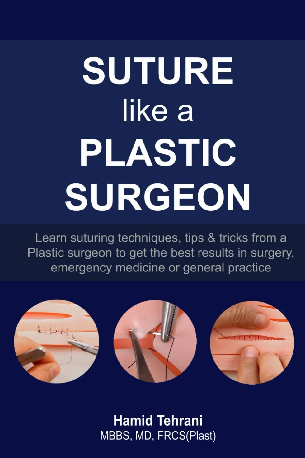 Suture like a Plastic Surgeon: learn suturing techniques, tips & tricks from a Plastic surgeon to get the best results in surgery, emergency medicine or general practice
