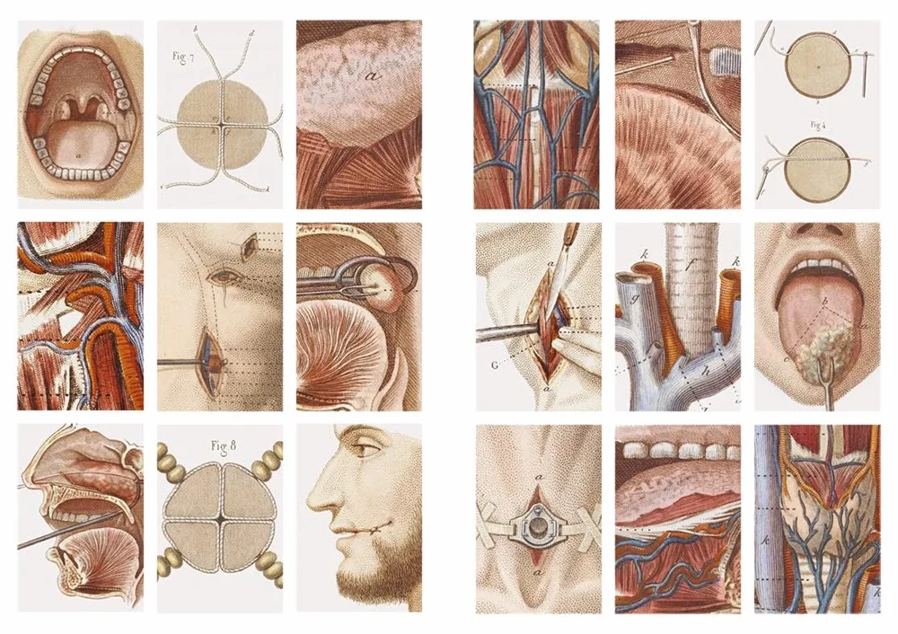 Crucial Interventions: An Illustrated Treatise on the Principles & Practice of Nineteenth-Century Surgery