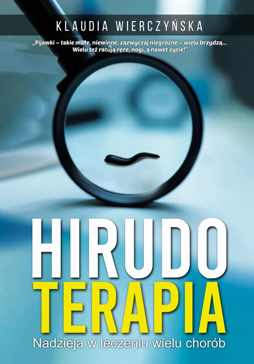 Hirudoterapia: Nadzieja w leczeniu wielu chorób
