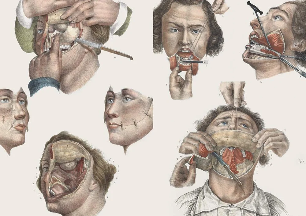 Crucial Interventions: An Illustrated Treatise on the Principles & Practice of Nineteenth-Century Surgery