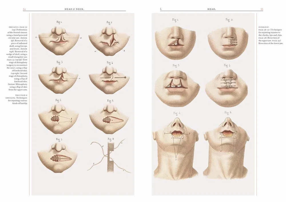 Crucial Interventions: An Illustrated Treatise on the Principles & Practice of Nineteenth-Century Surgery