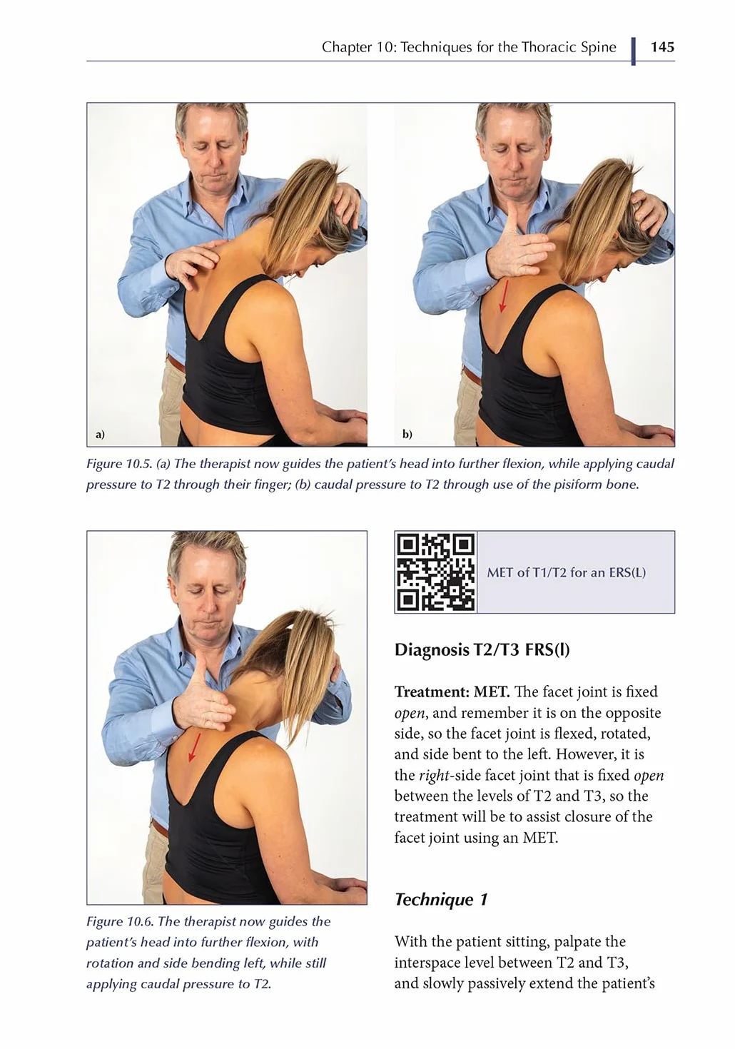 Spinal Manipulations and Mobilization Techniques: Theory and Practice