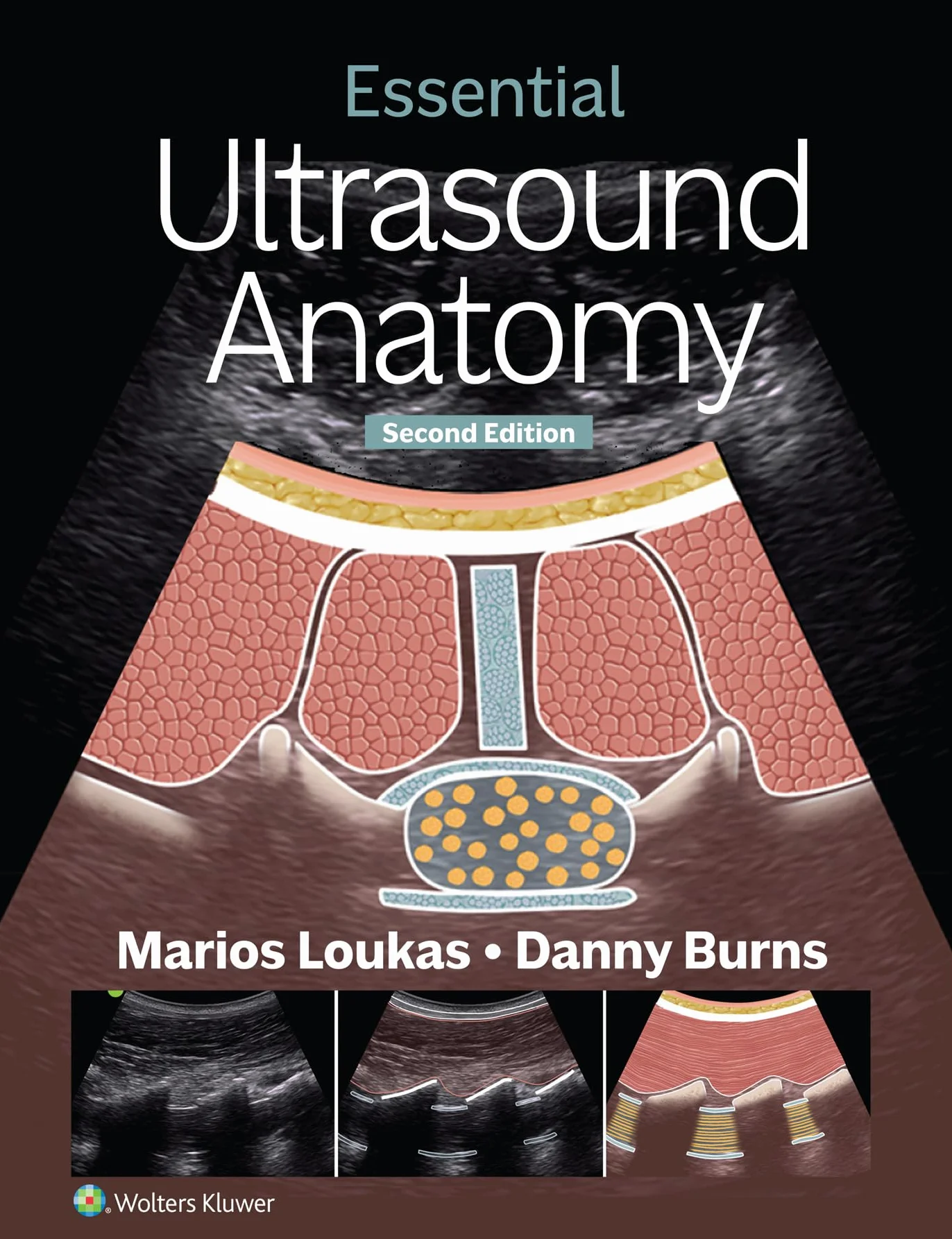 Essential Ultrasound Anatomy