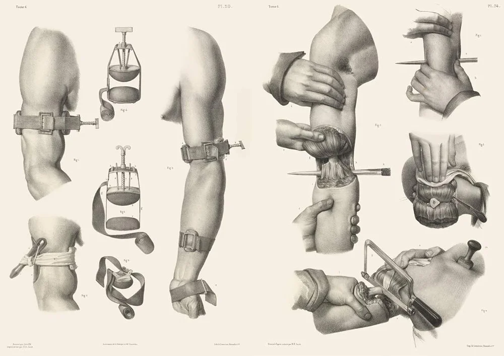 Crucial Interventions: An Illustrated Treatise on the Principles & Practice of Nineteenth-Century Surgery